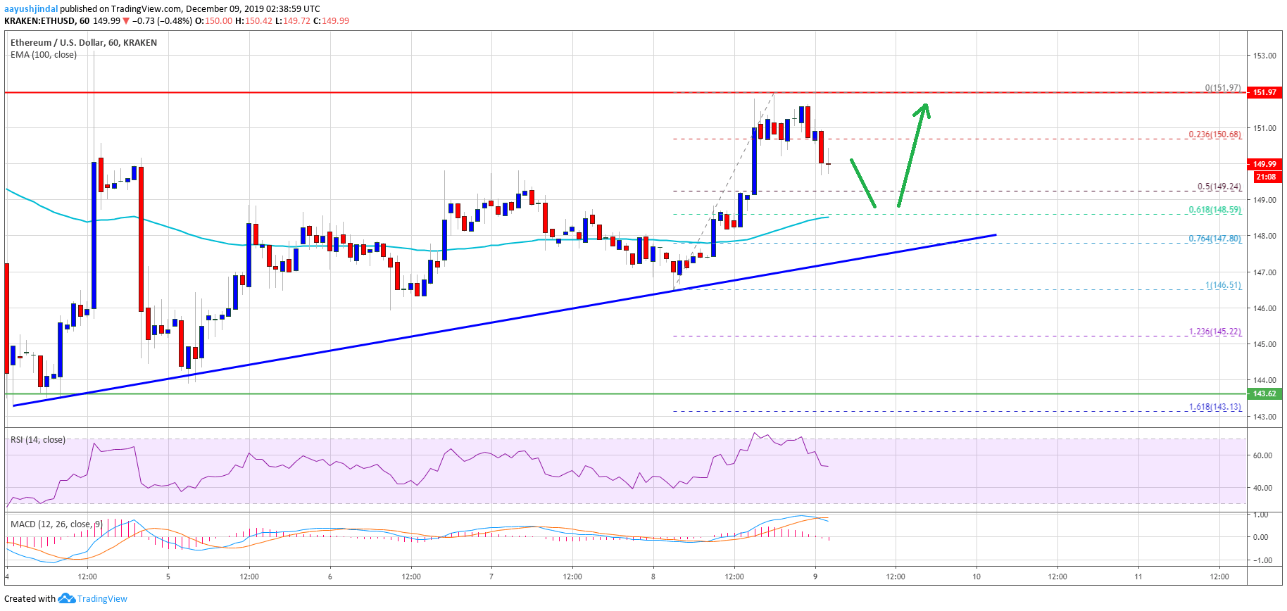 Ethereum Price ETH Chart